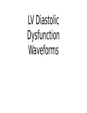 LV Diastolic Dysfunction Waveforms copy.pptx