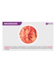 Amoebiasis.png