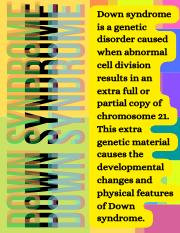 Down syndrome is a genetic disorder caused when abnormal cell division results in an extra full or p