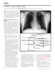 Chest x-ray made easy BMJ[All 5 articles].pdf