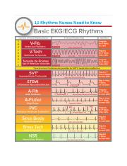 EKG JUST RHYTHM STRIPS nclex.pdf.docx