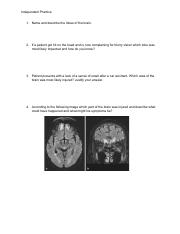 Valerie Escobedo - IP Nerves-Brain.pdf