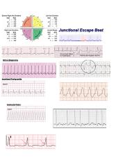 Clinical ECG cheat sheet.docx