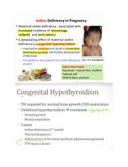 Congenital Hypothyroidism (Cretinism).docx