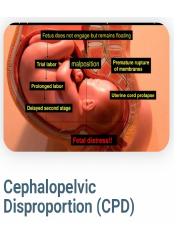 Cephalopelvic_disproportion_and_cord_prolapse1.pptx