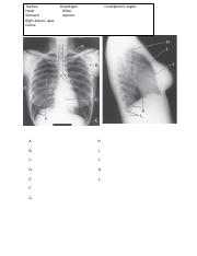 Anatomy chest & Abdomen image labeling (2).docx