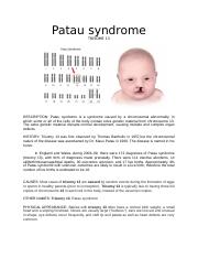 Syndrome patau Heart Defects