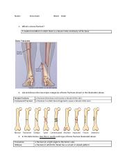 9.19.13 Bone fractures assignment.doc