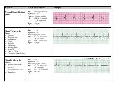EKG Flash Cards.pdf