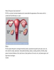 What is Polycystic Ovary Syndrome.pdf
