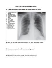 Basic Chest X-ray interpretation student worksheet.pdf
