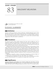 case study 83 malignant melanoma