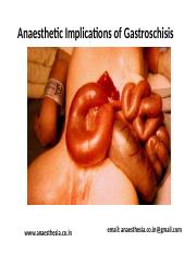 Gastroschisis-2.ppt