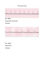 EKG Practice strips.docx