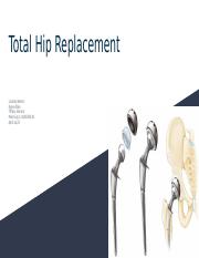 Total Hip Replacement.pptx