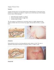 Staging of Pressure Ulcers.doc