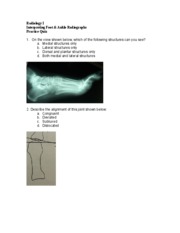 Radiology I Quiz-Interpreting Foot and Ankle Radiographs