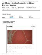 Lab 6 Exam - Requires Respondus LockDown Browser + Webcam_ Essential Human Anatomy & Physiology II w