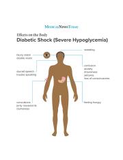 diabetic-shock-severe-hypoglycemia-effects-on-the-body-series-br-image-credit-stephen-kelly-2019-br.