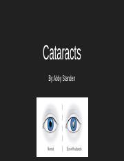 Cataracts.pptx
