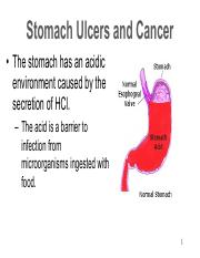 4_Stomach_Ulcers_and_Cancer.pdf