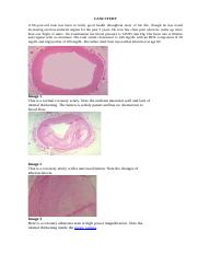 Case study atherosclerosis.docx